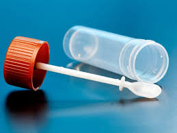 Beef Welfare Scheme Faecal Testing Kit - Worm Test